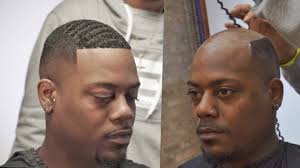 Many hair tonics promise to regrow thinning hair. Crazy Man Weave Transformation Instead Of Hair Transplant Man Weave Hair Transplant Crazy Man