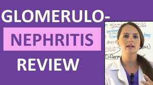 } acute nephritis presentation (nephritic syndrome) with proteinuria, hematuria, volume overload, hypertension, and renal impairment. Nephrotic Syndrome Nursing Nclex Lecture On Pathophysiology Treatment In Children Pediatric Youtube