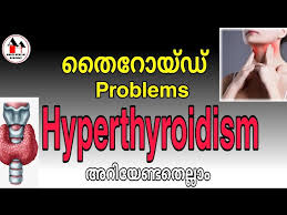 Thyroid information about thyroid disease, treatment therapies and prevention, covering topics such as thyroid nodules, hashimoto's thyroiditis, hyperthyroidism and hypothyroidism. Common Thyroid Problems Hyperthyroidism In Malayalam Youtube