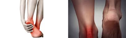 They come in many shapes and sizes, from small ones which enable. Leg Pain Treatment By Northwest Indiana Podiatrist