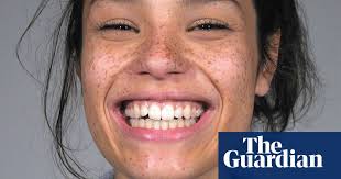 Dental bonding is not permanent and the composite material may stain over time (if you smoke or eat or drink colored foods and liquids), but it is the quickest and cheapest method of correcting gaps in between teeth. Forget Flossing Four Alternative Ways To Keep Your Teeth Healthy Health Wellbeing The Guardian