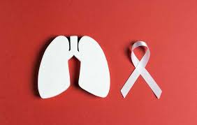 As diagnoses continue to stack up year after year, it is predicted that cancer will surpass heart disease as the leading cause of death in america. Report Lung Cancer On The Rise In Bangladesh Dhaka Tribune