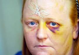 Stockton mum battered by woman burglar