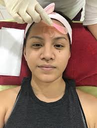 Dr ranjit is fluent in english. Dr Ko Skin Specialist Price