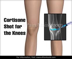 There are no medical restrictions about the types of conditions that can be treated with these injections. Cortisone Shots For Joint Pain Knee Hip Ankle Spine Wrist