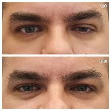 ד"ר אירינה יפימוב