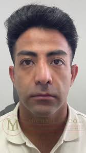 Michael J Yoo Surgeon