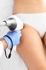 Hair removal works on all areas of the body that has unwanted hair including the face, chest, abdomen, pubic area, (bikini and brazillian areas), as well as legs, arms, hands and feet. Woman On Laser Hair Removal Treatments Thighs And Bikini Area Stock Photo Picture And Royalty Free Image Image 67467212