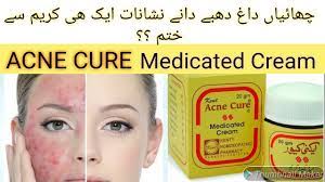 Acne Cure Medicated Cream Honest Review Youtube