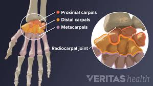Image result for Normal Anatomic Position of the Hand and Wrist