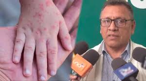 Hipótesis: Caso cero de sarampión habría llegado a Bolivia en congreso  religioso