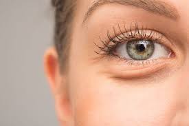 Goz Alti Torbalari Nasil Gecer Goz Alti Torbasindan Kurtulmanin 5 Basit Yolu Dark Circles Under Eyes Dry Eyes Causes Natural Moisturizer