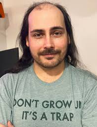 You might have a point ... with the hair, you look like you drive a  windowless van with, "Free Candy" written