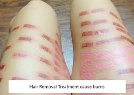 This article will answer through these questions. 6 Most Common Myths About Laser Hair Removal