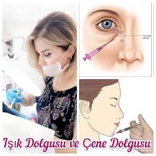 Isik Dolgusu Goz Yasi Olugu Tedavisi Yas Almaya Bagli Bazen Ise Yapisal Ozelliklere Bagli Olusan Ve Tear Through Deformite Hyaluronik Asit Yuzler Gozler