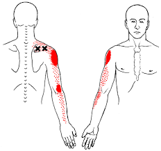 Come dovrebbe essere posizionata normalmente la vertebra cervicale? La Perdita Della Fisiologica Lordosi Cervicale Ross Brennan Chiropratico