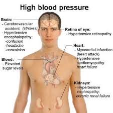 blood pressure causes symptoms and types blood pressure