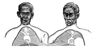 6 Things You Probably Don T Know About Conjoined Twins Fitness Make social videos in an instant: