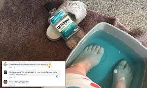 My foot was really soft and most of the dry dead skin came off. Cleaning Fan Reveals Unusual Mouth Wash Hack For Getting Rid Of Dead Skin On Your Feet Daily Mail Online