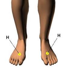 Acupressure Points For Diabetes Curing Acupressure Points