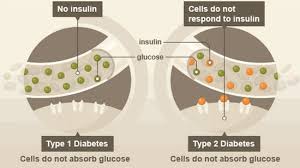 Sentiasa menjaga pemakanan dengan teliti dan mengikut saranan doktor. 7 Tanda Awal Kencing Manis Diabetes Type 2 Genkimomma My Genkimomma My