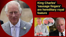 King Charles' 'sausage fingers' are hereditary royal feature he's ...