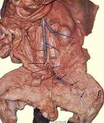 Branches off the internal thoracic artery and runs along the costal margin to supply the hypochondriac region of the abdominal wall and the anterolateral muscles and the diaphragm. Bio202 Cat Vessels