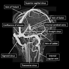 People who have had any type of stroke recover best if they get treatment right away. Cerebral Venous Thrombosis A Practical Guide Practical Neurology