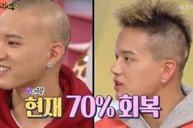 Because of this, melodys were very happy for btob's peniel when he shared an image of an amazingly organized plate with the caption, trying to eat healthy again last month.with two juicy burger patties along with an assortment of cooked vegetables, peniel's meal not only looked tasty, but quite nutritious as well! Btob S Peniel Gives Update On His Struggle With Hair Loss Soompi