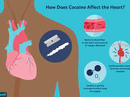 How Cocaine Affects The Cardiovascular System