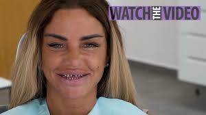 Katie price veneers fall out. Katie Price Spits Out Her Fake Teeth After They Fall Off Her Bond Villain Stumps As She Gets Veneers Replaced