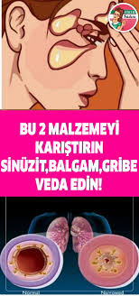 Pin On Saglik Bilgileri Health Gesundheit Sante