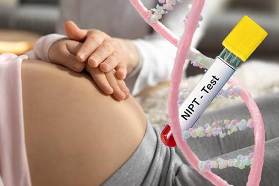 Everything you need to know about your NIPT test report – MyDiagnostics