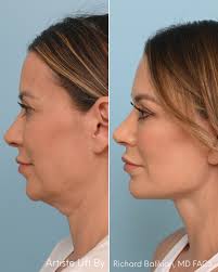 Balikian Plastic Surgery added...