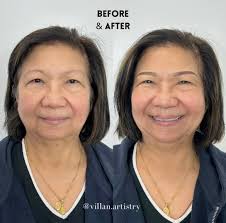 Huntington Beach CommUNITY Voice