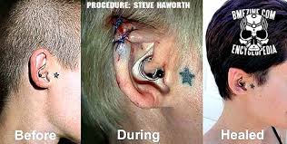 Here you can see that russ foxx actually offers pictures of each stage of the healing process proving that elf ears are an entirely possible body modification. Another New Body Modification Elf Ears Gallery