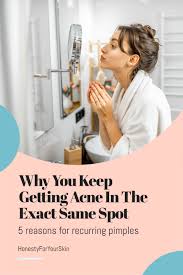 The single best way to flatten a cystic pimple quickly. Recurring Cystic Pimple Same Spot 5 Reasons Why You Re Getting It