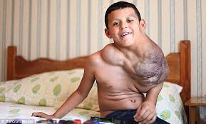 He is best known for his appearance on the x factor season 2. Boy 11 Has Massive Tumor Removed In 12 Hour New Mexico Surgery Two Years After U S Forces Helped Pull Him Out Of Mexico S Deadliest City Daily Mail Online