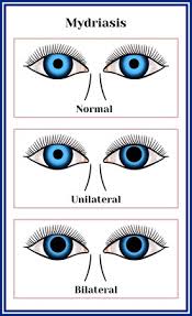 Mydriasis Expansion Of A Pupil Chart Illustration Royalty