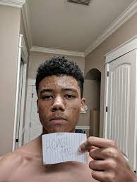 Check spelling or type a new query. Roast Me And My Pizza Face 17 Yrs Roastme