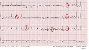 Image result for J Wave