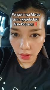 Bopeng Jerawat: Pergi Melawan Bekas dan Scar!