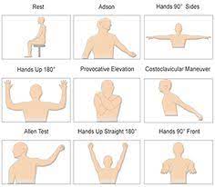 100 Thoracic Outlet Syndrome Tos Ideas Thoracic Syndrome Fibromyalgia