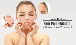 What is the best treatment peel or something else like laser etc.? How To Reduce Skin Pigmentation With Ayurvedic Treatment Ath Ayurdhamah