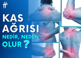 Kas Ağrısı (Miyalji) Nedenleri ve Tedavi Seçenekleri Turan&Turan