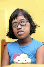 Sri Lankan observers at the Victorian Adult Burns Services at The Alfred  Hospital