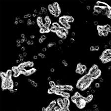 Often that means on his own home turf, with all his comforts within arm's reach. Scientists Are Just Beginning To Understand Mysterious Dna Circles Common In Cancer Cells The New York Times