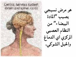 ما هو التصلب المتعدد (اللويحي) : Ù…Ø§ Ù‡Ùˆ Ù…Ø±Ø¶ Ø§Ù„ØªØµÙ„ Ø¨ Ø§Ù„Ù„ÙˆÙŠØ­ÙŠ Ø§Ù„Ù…ØªØ¹Ø¯Ø¯ Ms Disease Youtube