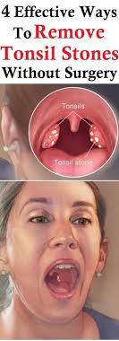 Pin On Health
