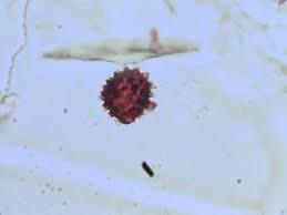 Image result for Melastomastrum segregatum